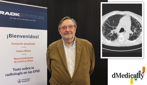 Entrevista al Dr. Tomàs Franquet, jefe de sección de Radiología Torácica del Hospital Sant Pau de Barcelona