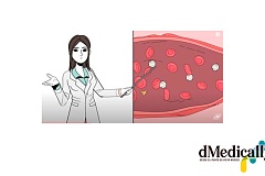 Las pacientes con síndrome antifosfolípido deben planificar el embarazo